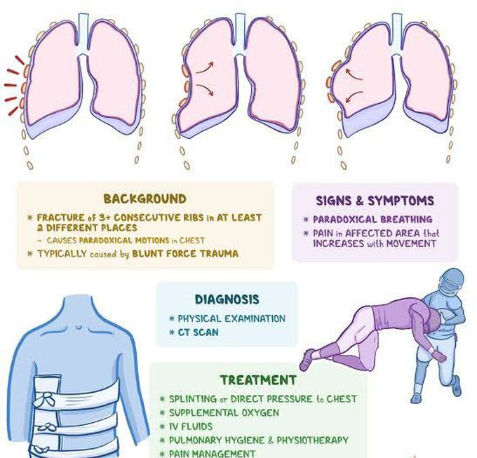 flial-chest-medizzy