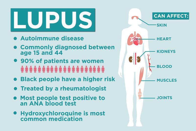 Lupus - MEDizzy