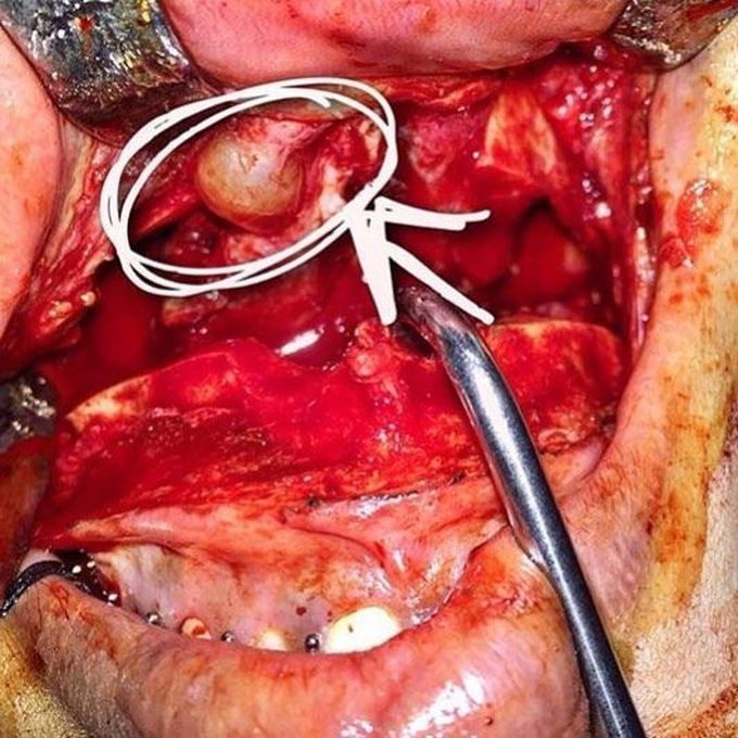 Diagnose this??