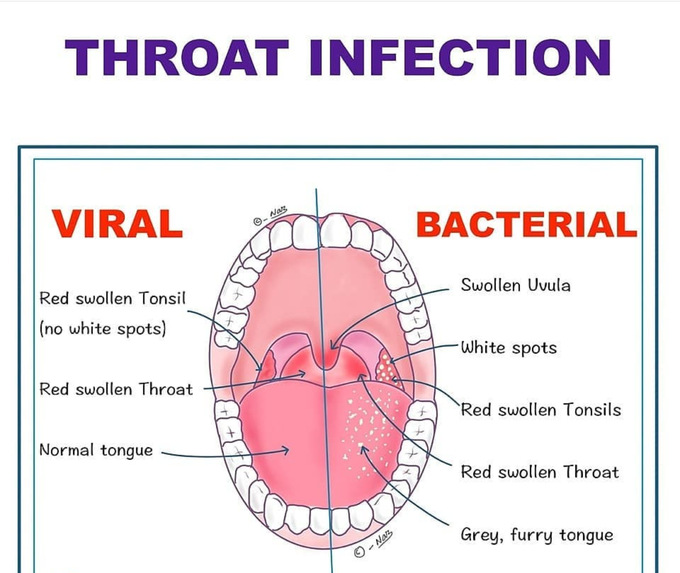 Viral or bacterial? - MEDizzy