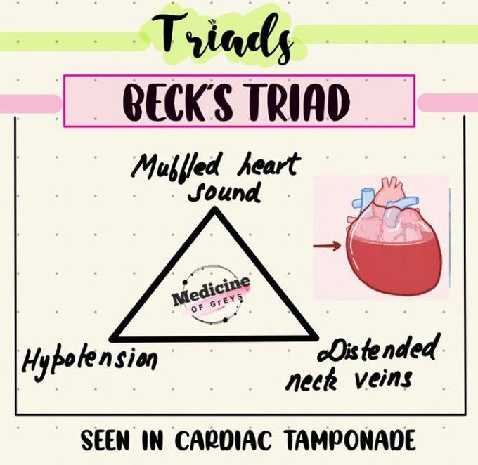 Beck's Triad