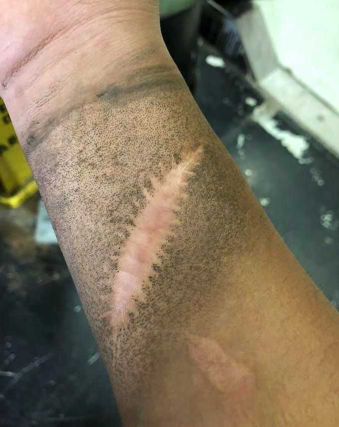 An interesting photo, showing how dirt doesn't stick to scar. Can you guess why? 👇 