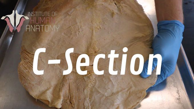 The Anatomy of a C-Section
