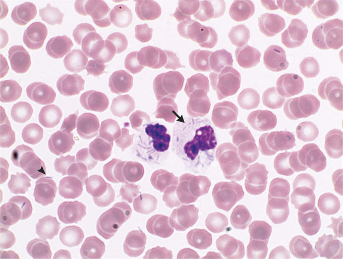 Case Of Capnocytophaga canimorsus Infection In 62-Year-Old