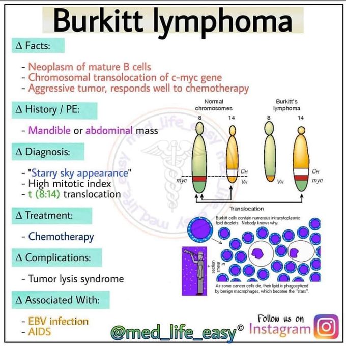 Burkitt lymphoma