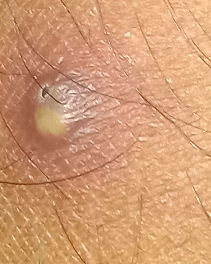 Please search skin condition