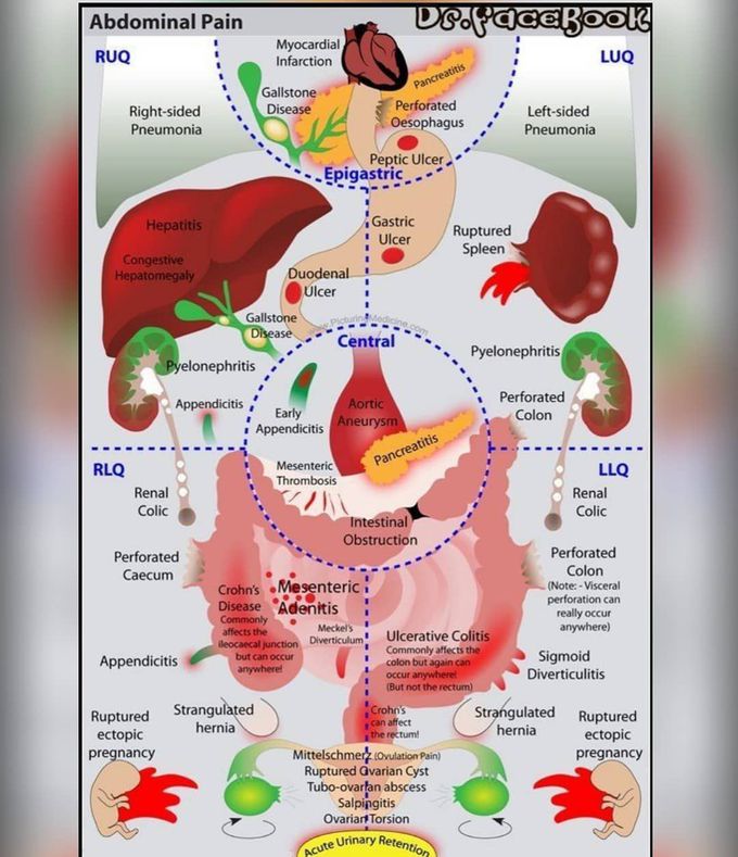Common causes of abdominal pain