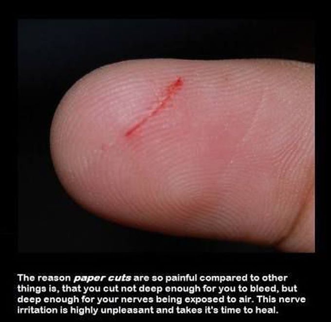 Paper cuts😕