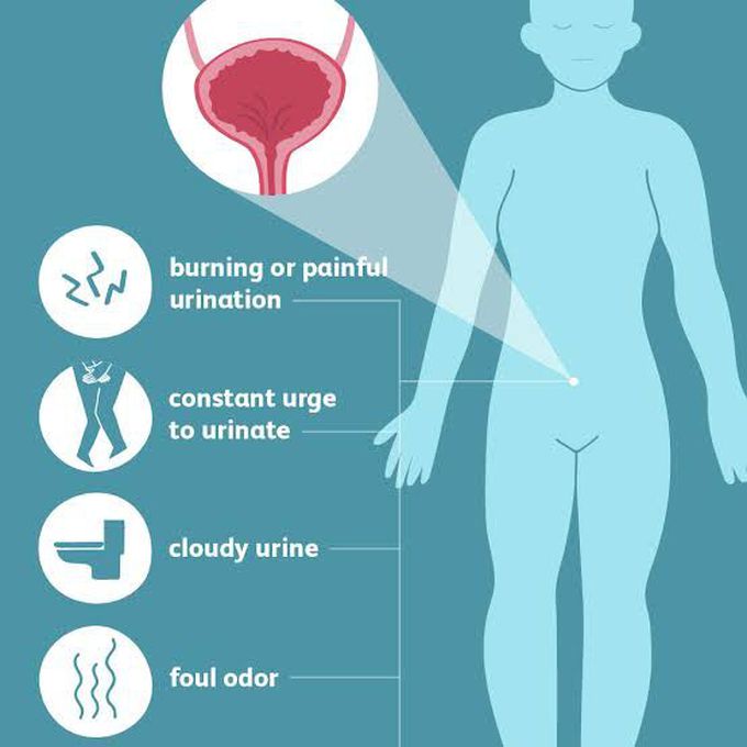 These are the symptoms of UTI