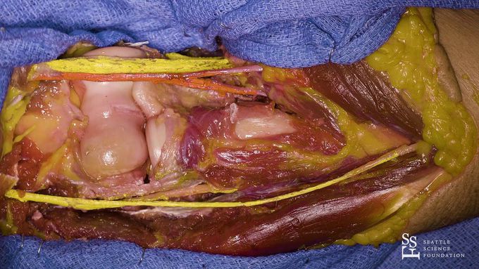 Dissection of right elbow joint - R. Shane Tubbs, Ph.D., PA-C