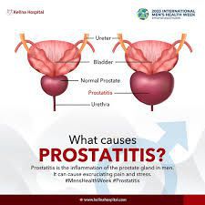 Causes of prostatitis - MEDizzy