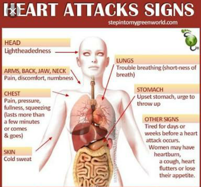Heart attacks signs