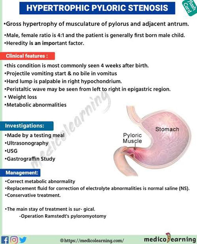 Hypertrophic pyloric stenosis