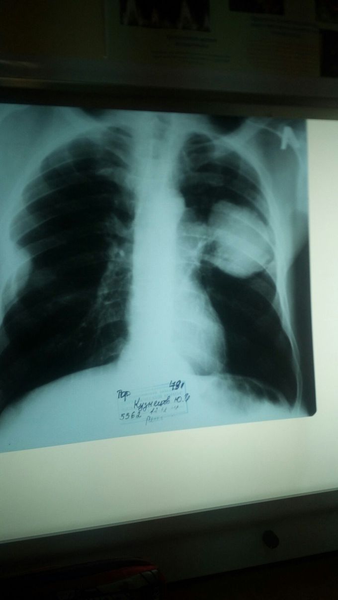 What is diagnosis....?