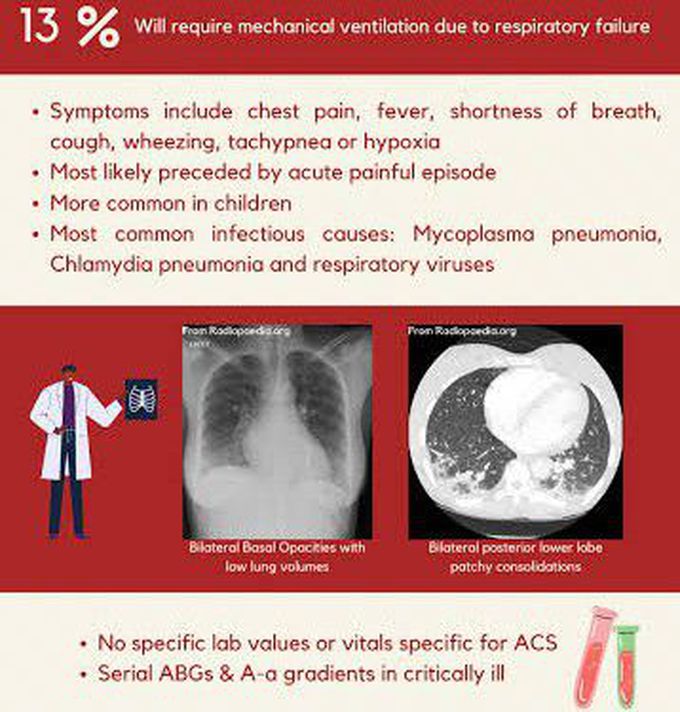 These are the symptoms of Acute chest syndrome