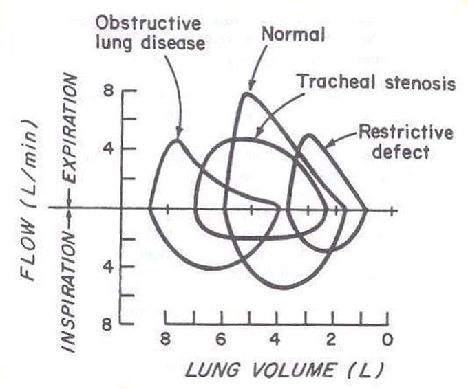 Normal Lung Vs Pulmonary Pathologies