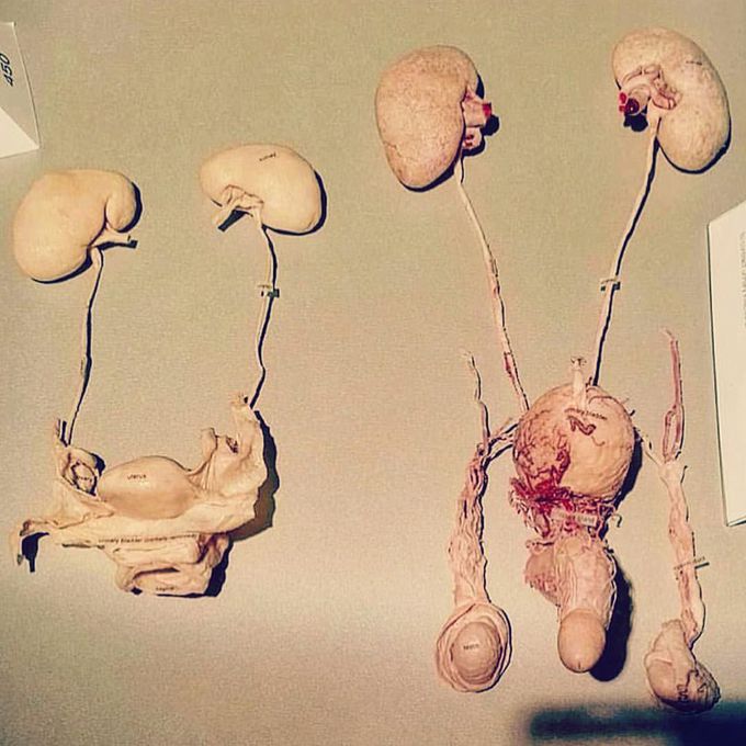 This is a very unique shot showing the female (Left) Vs male (Right) genitourinary system
