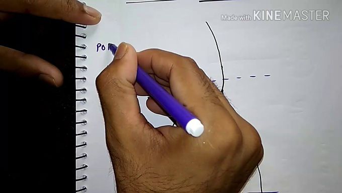 How to draw common peroneal Nerve