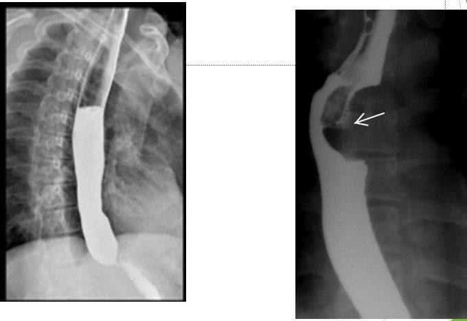 Identify the Pathology