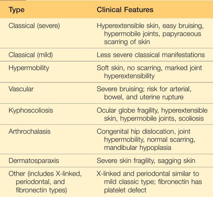 Ehler Danlos Syndromes