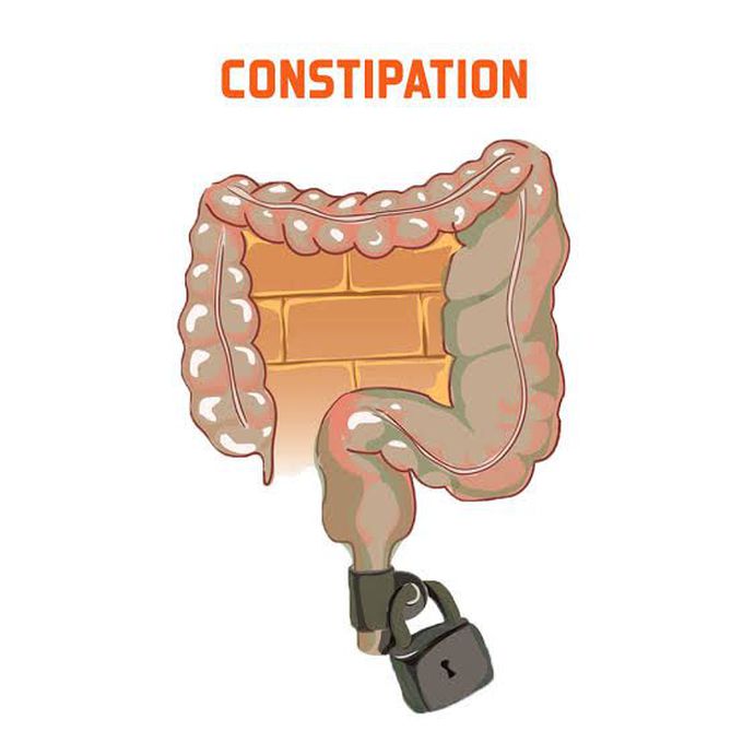 Symptoms of constipation