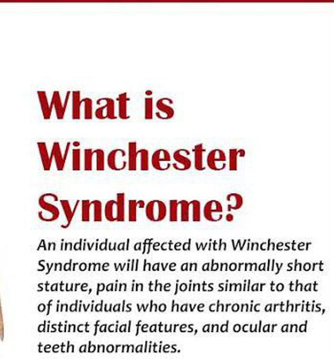 These are the symptoms of Winchester syndrome