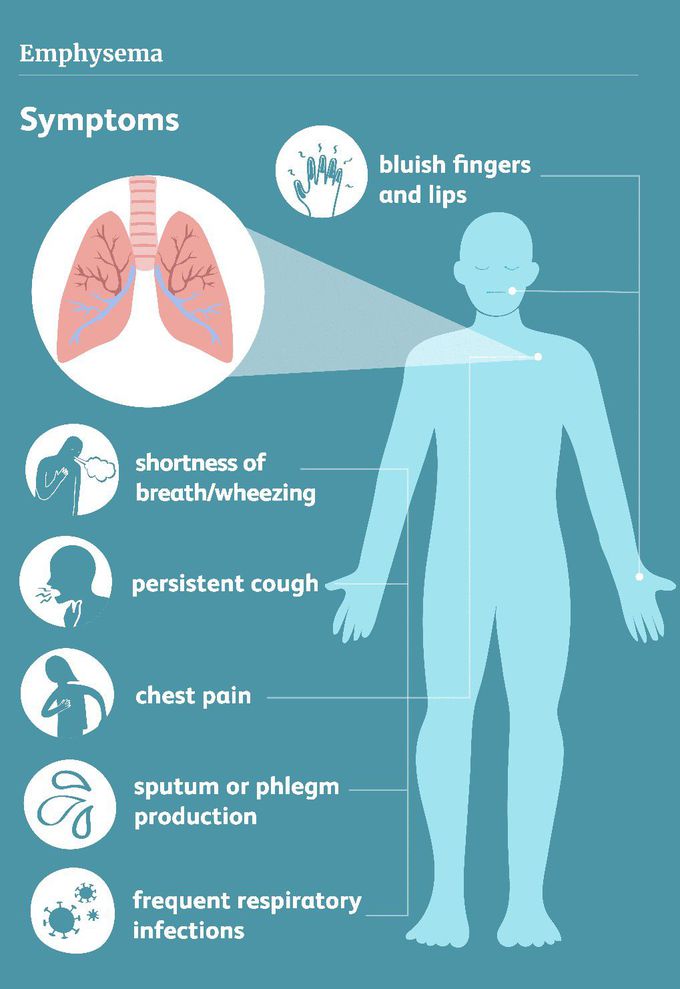 Symptoms of Emphysema