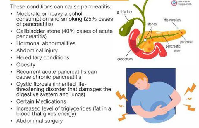 These are the causes of pancreatitis