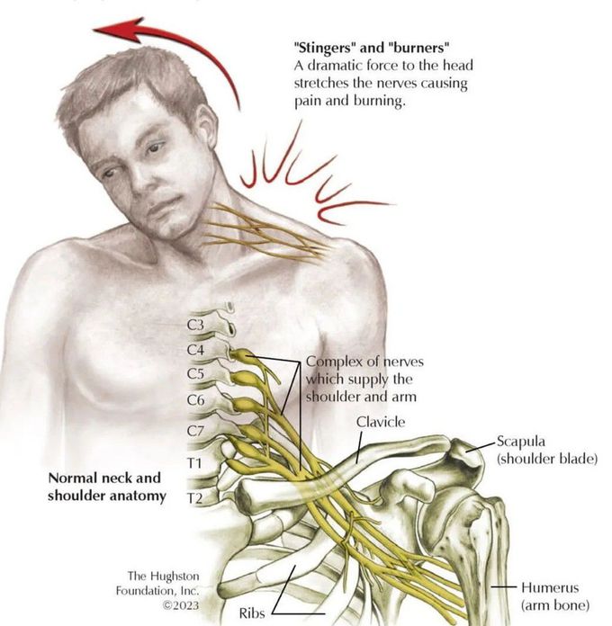 Problems with Branchial Plexus