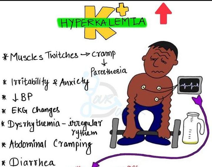 Hyperkalemia