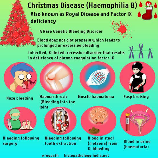 Osmosis from Elsevier - Christmas disease, also known as Hemophilia B, has  nothing to do with the Holidays; it was actually named after the first  patient diagnosed with it—Stephen Christmas. Christmas disease