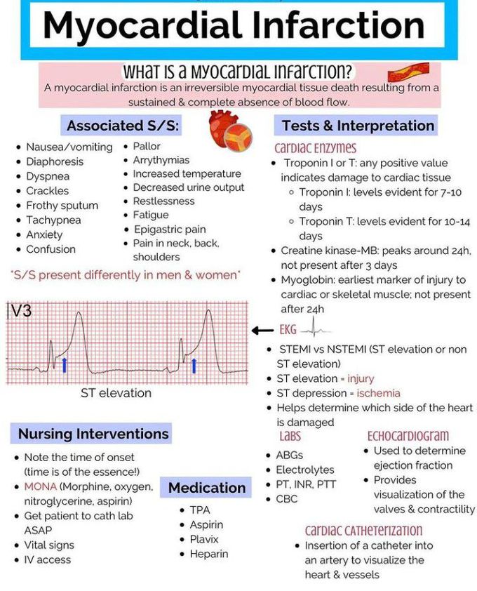 Myocardial Infarction