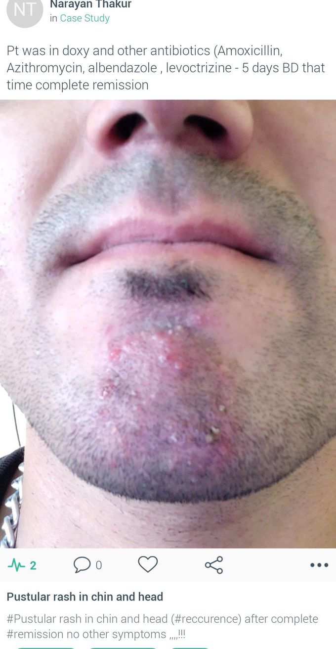 Pustular rash