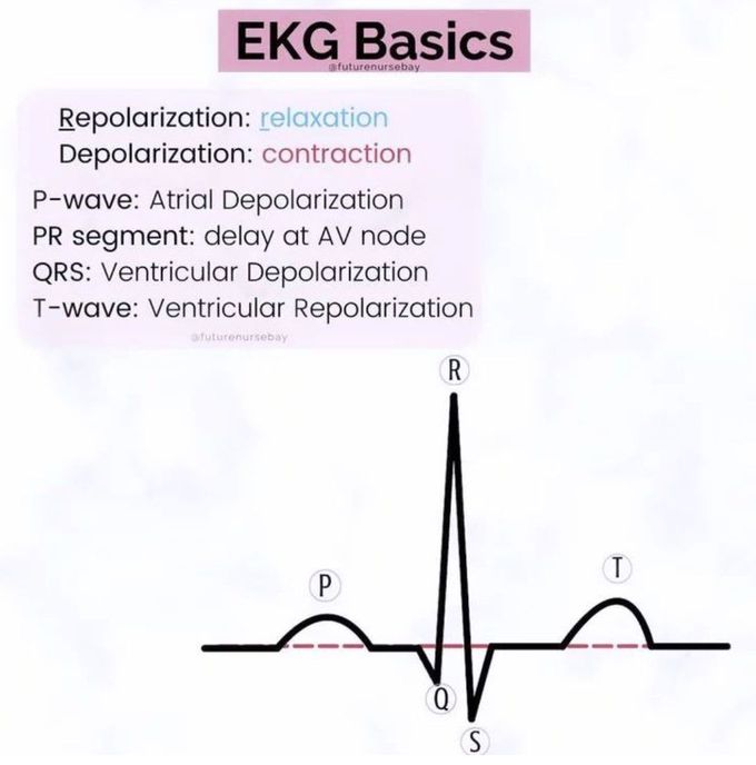 EKG Basics