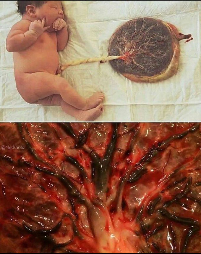 The placenta