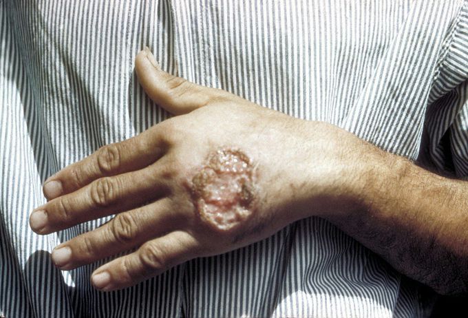 What's your diagnosis!?