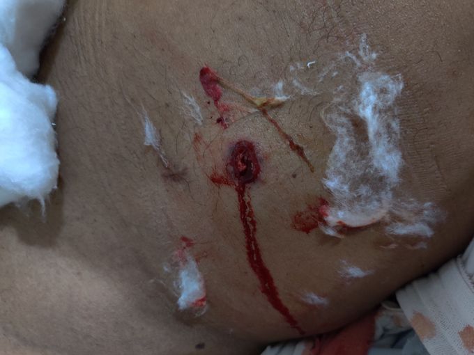 Gun shot