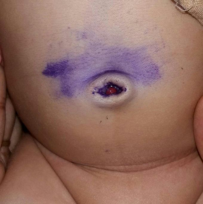 Diagnosis?