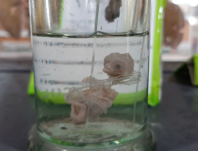 ECTOPIC TUBAL BABY