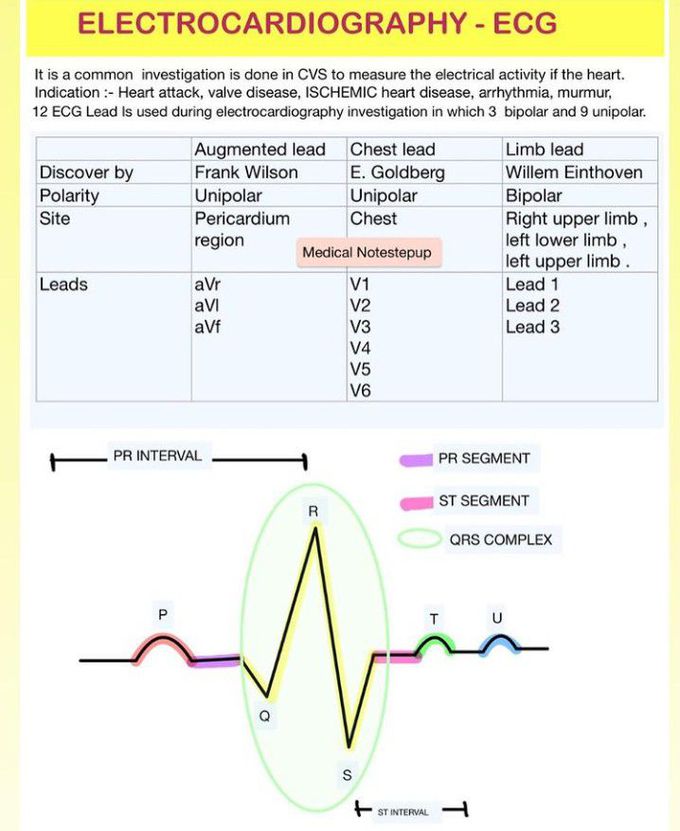 Electrocardiogram