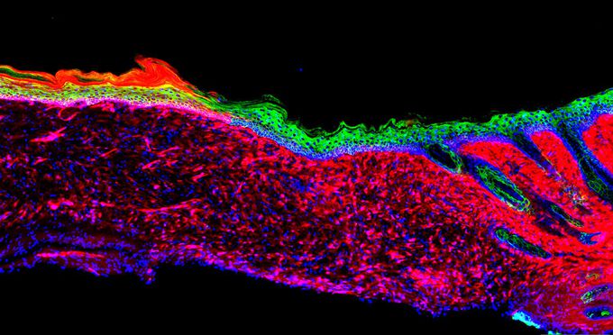 The alchemy of healing: researchers turn open wounds into skin