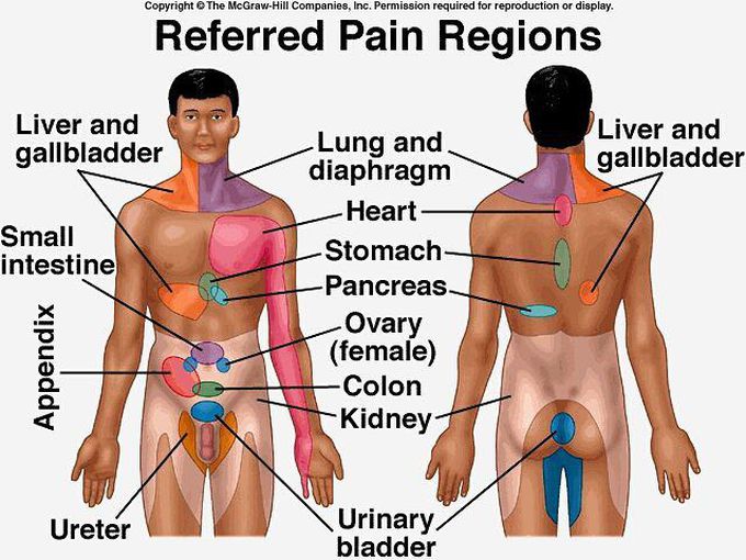 Referred Pain