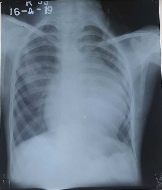 What's your diagnose ?