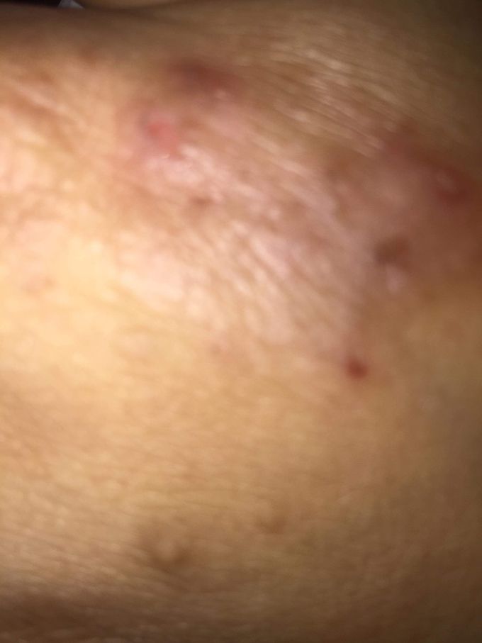 Can you diagnose it pleas?