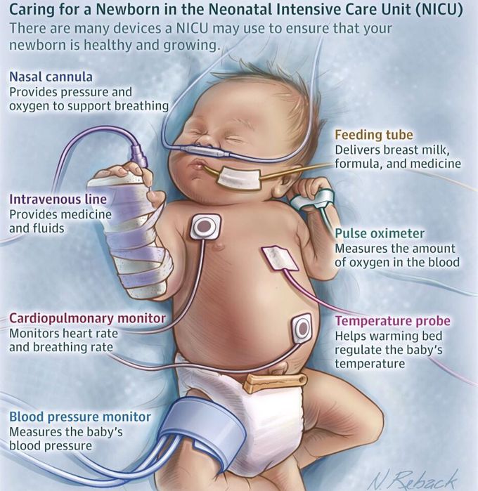 NICU CARE
