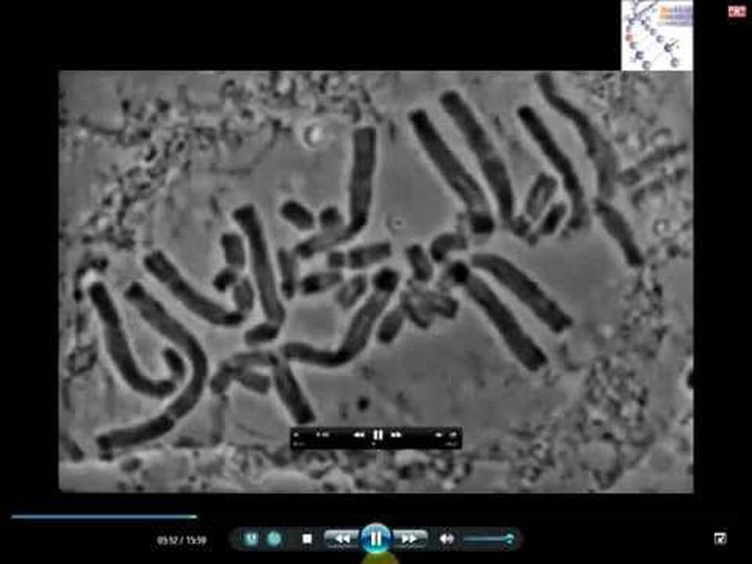 Microscopic view of Mitosis
