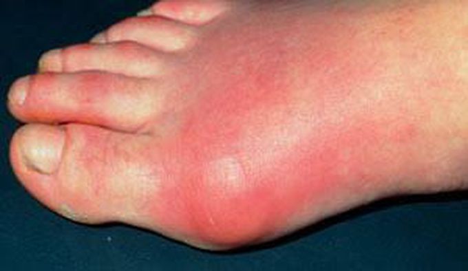 What is your diagnosis??