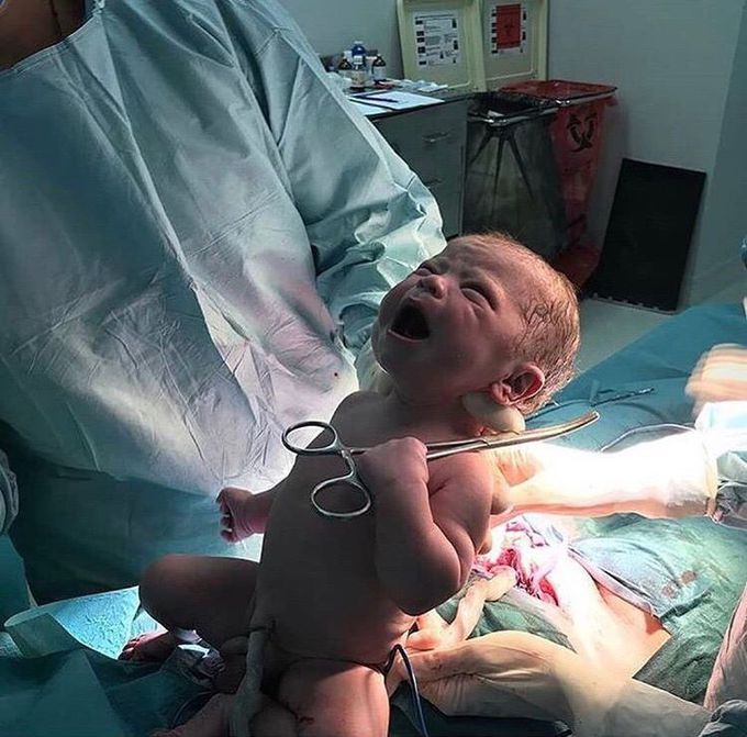 Cesarean section
