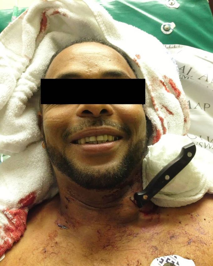 This is the happiest guy I have ever seen with a knife in his neck. Hands down.