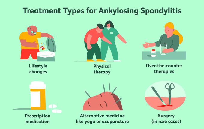 Treatment for Ankylosing spondylitis